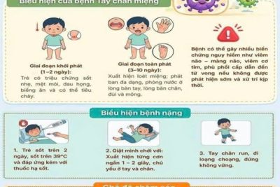 BÀI TUYÊN TRUYỀN QUÝ III NĂM 2026 VỀ PHÒNG CHỐNG DỊCH BỆNH TAY CHÂN MIỆNG